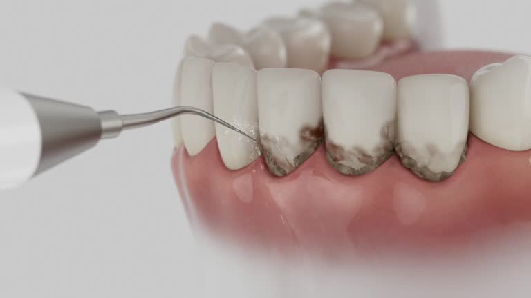 Reliable Dental contractor in Clay, CA by Smile Center Dentistry